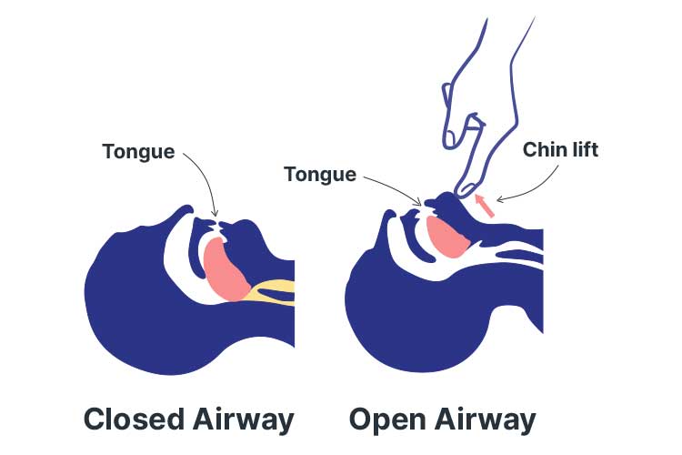 BLS Training Image