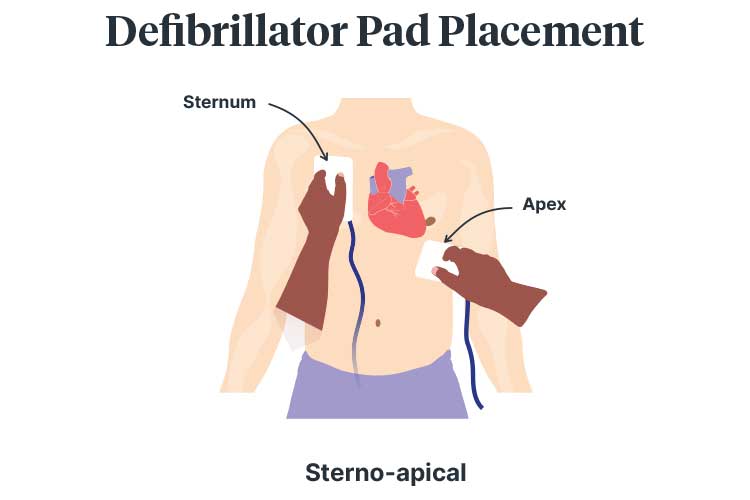 BLS Training Image